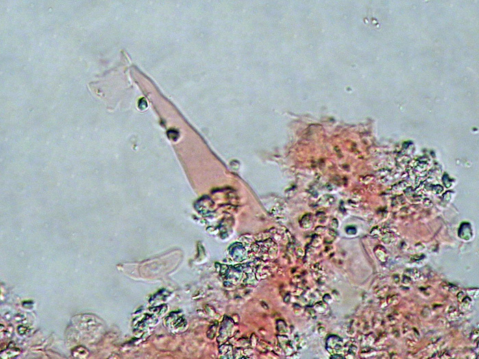Penso ad un Vuilleminia sp-foto5046 (Vuilleminia cystidiata)